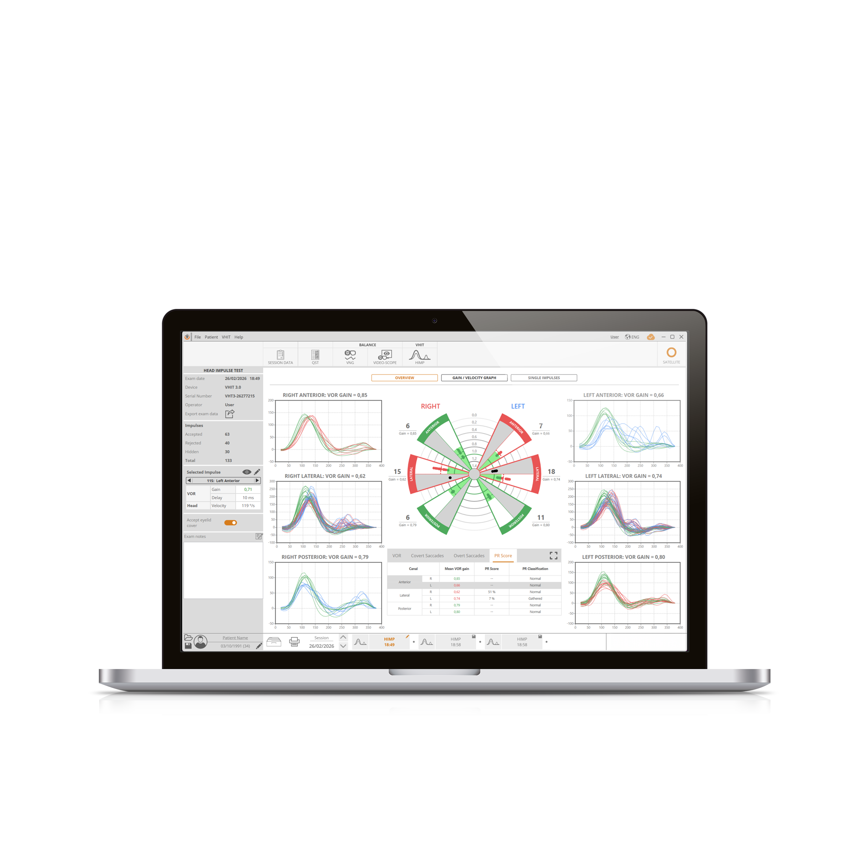 VHIT new software