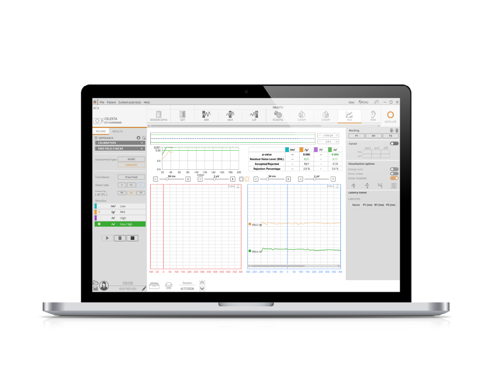 HEARLab® ACA acquisition 1