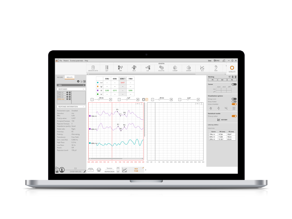 HEARLab® ACA visualization 3