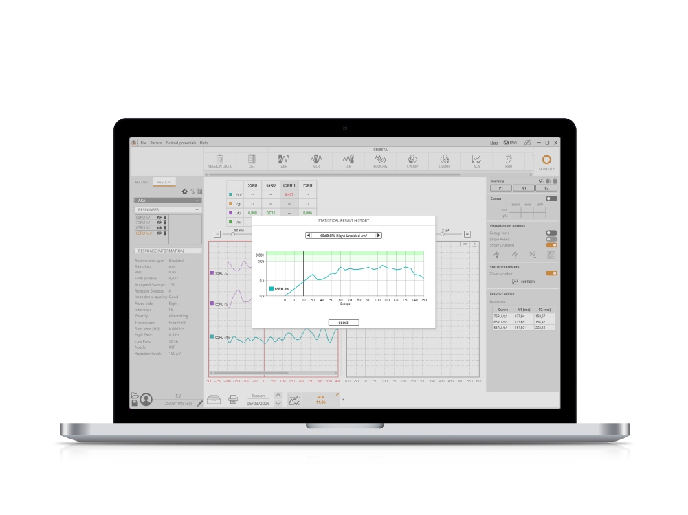 HEARLab® ACA visualization 4