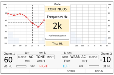 PTA screen – pure tone threshold acquisition