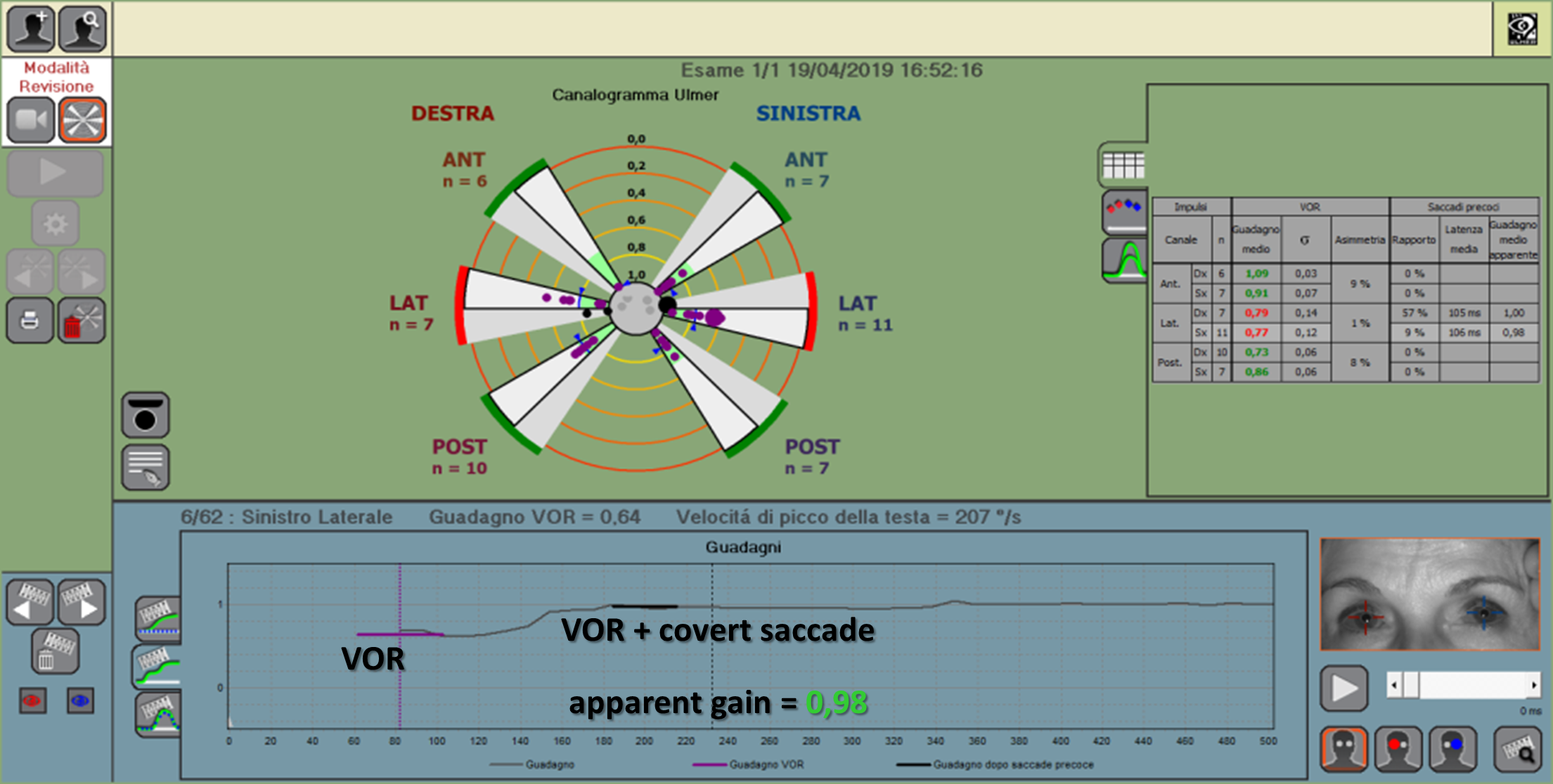 VHIT calculation of the apparent gain after covert saccade
