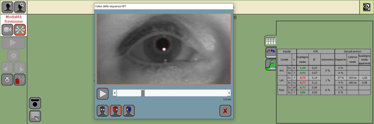 VHIT evaluation of the eye movements in slow motion