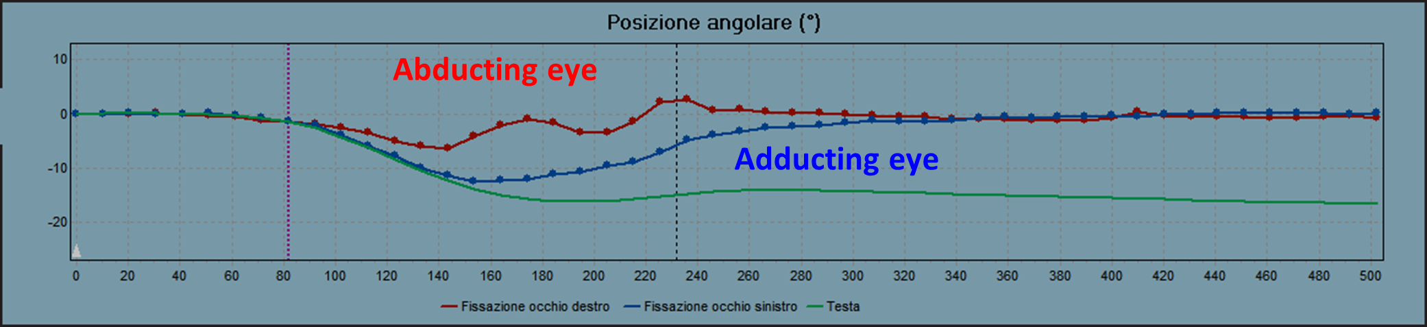 VHIT gaze position graph